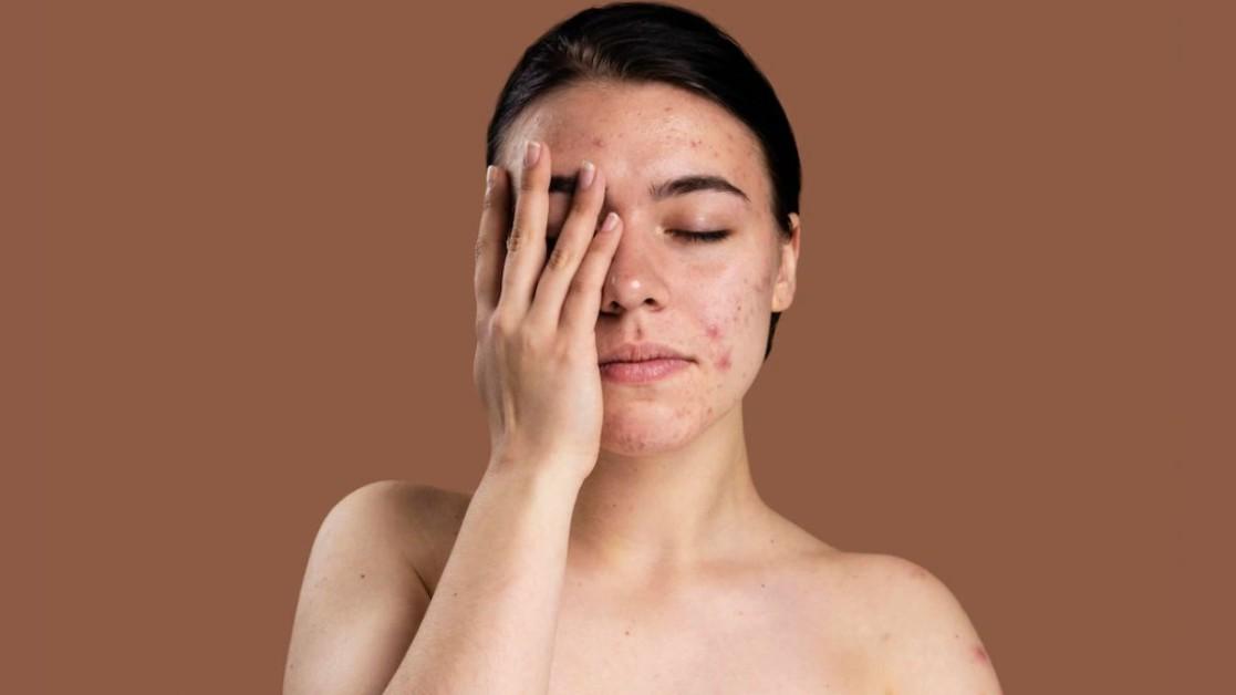 How Air Pollution Affects Your Skin and How to Protect It