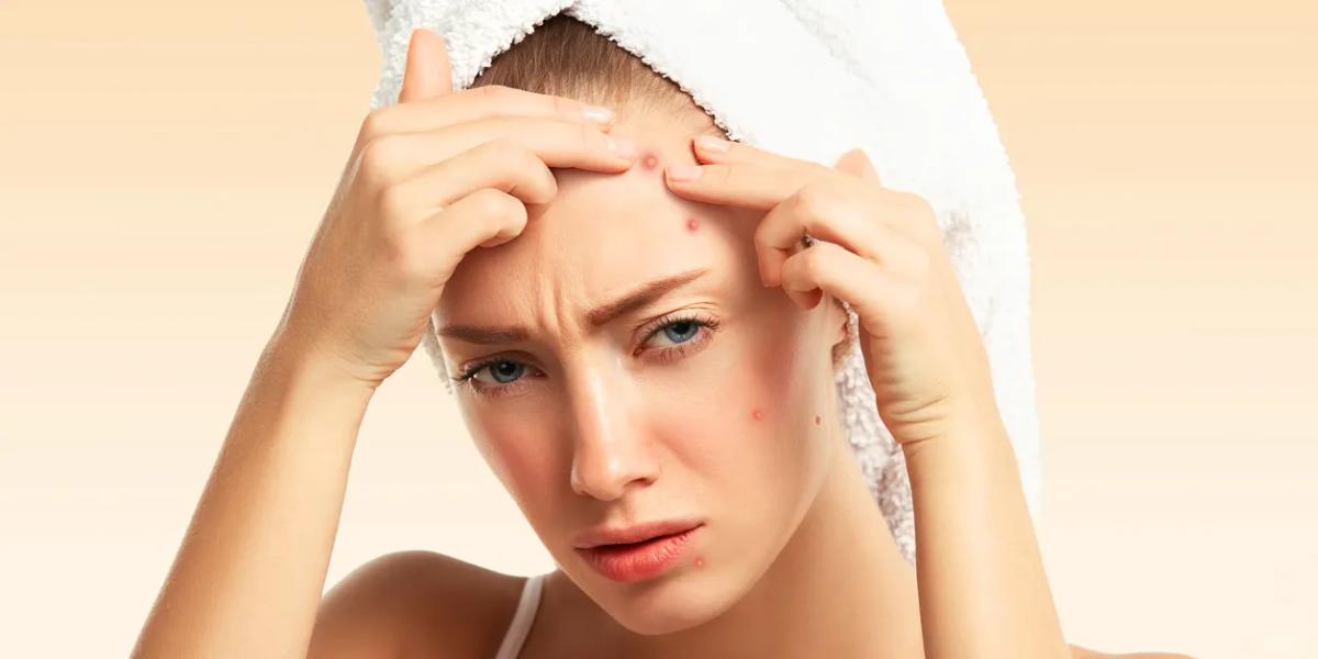 How Stress Affects Your Skin and What You Can Do About It