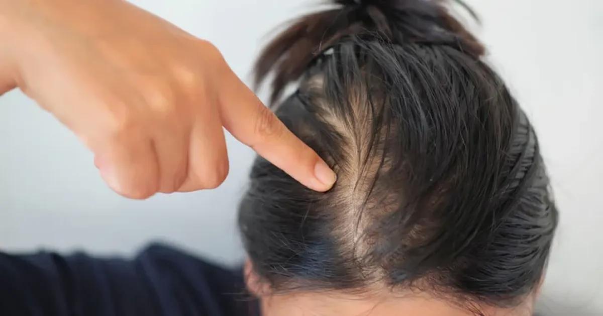 How to Prevent Hair Thinning: Top Products & Proven Practices