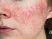 is-your-skincare-rou_1733830424441147971.webp