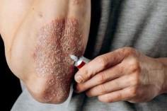 how-to-manage-skin-c_1735029602488192928.webp