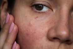 is-your-skincare-rou_173451897524439484.webp