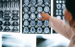 ucla-scientists-deve_1745241583760443148.webp